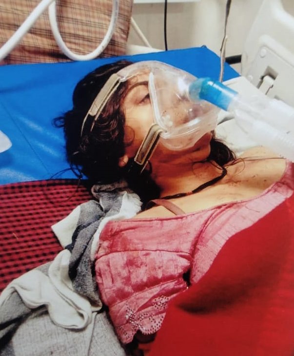 सडक़ हादसे में नवविवाहिता की मौत, पुलिस ने पति पर लापरवाही से वाहन चलाने का प्रकरण दर्ज किया 